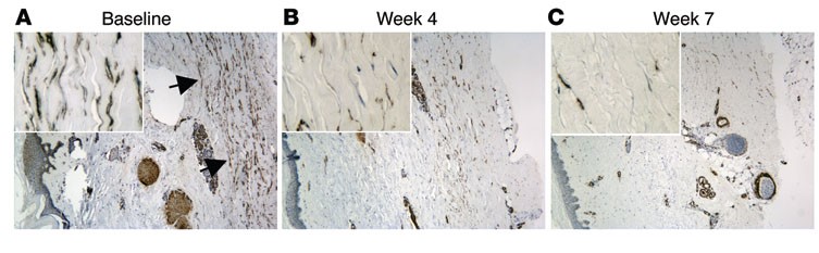 Photos showing skin biopsies.