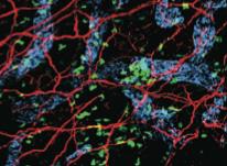 Microscope image showing cells (in color) that drive inflammation in psoriasis.