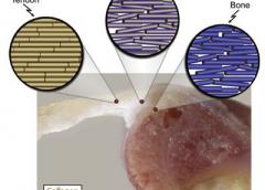 The tendon-to-bone insertion point is biomechanically compositionally and structurally complex. Photo credit: Stavros Thomopolous Ph.D. Department of Orthopaedics Washington University.