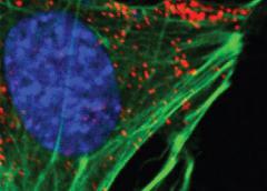 Red staining in this cell represents the presence of a newly discovered  thyroid hormone receptor p30 TRα1 in signaling “hubs” areas where  signaling molecules congregate in the cell membrane.  Credit: Renate Pilz M.D. University of California San Diego.