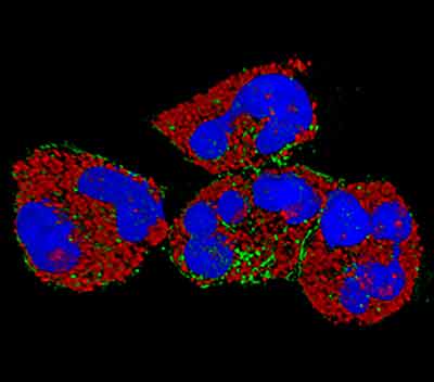 Neutrophils