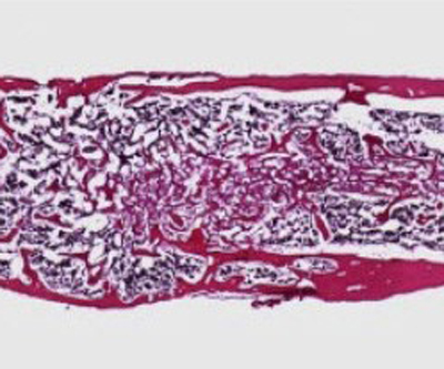 Bone-Building Protein