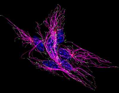 Primary myoblasts