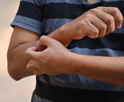 Boy in black and blue shirt scratching his arm