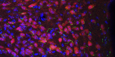 mouse neurons (purple) with their nuclei (blue) and primary cilia (green)