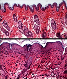 Atopic cells