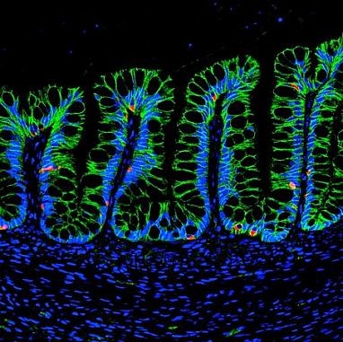 "After transplantation into an animal, human intestinal organoids differentiate into mature intestinal tissue with specialized cell types, such as enteroendocrine cells (red).