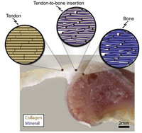 The tendon-to-bone insertion point