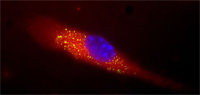 MRSA toxin bound to nanosponge 